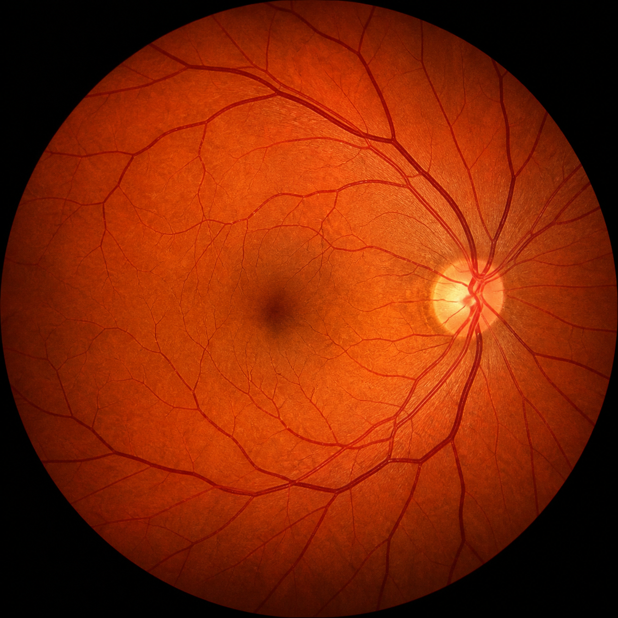 Retinal image